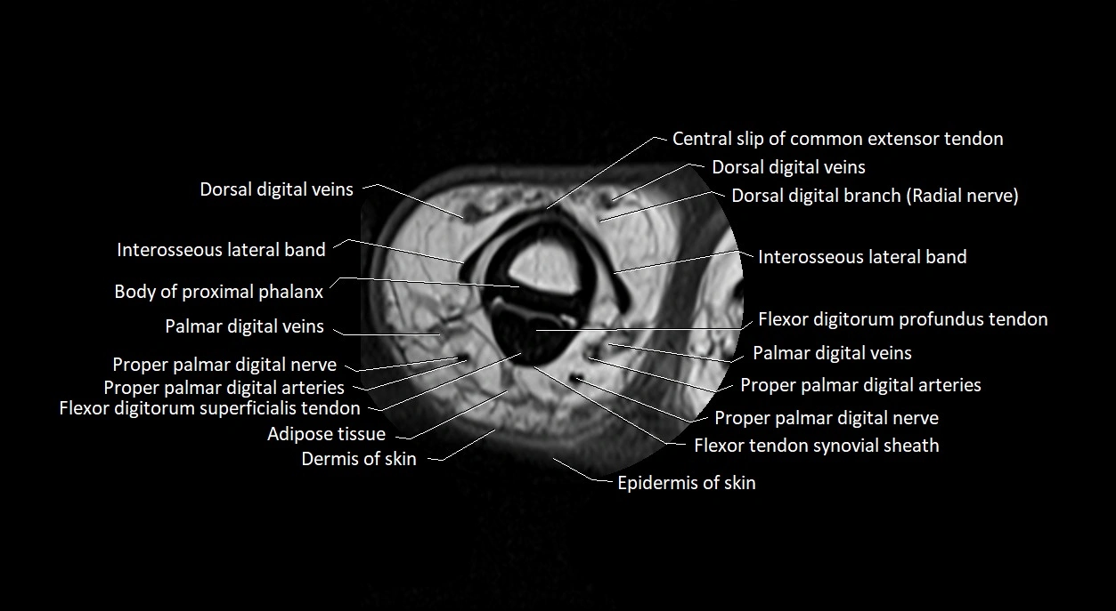 Finger anatomy axial cross sectional 3T image image 18.webp